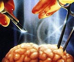 ThumbBC84
